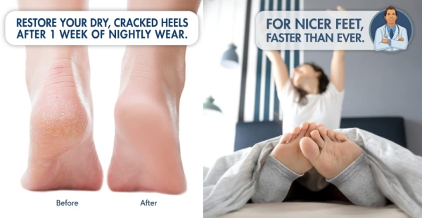 Purchase Dr. Frederick's Original Moisturizing Heel Socks for Cracked Heel Treatment - 2 Pairs - Stop Cracked Heels in Their Tracks on Amazon.com