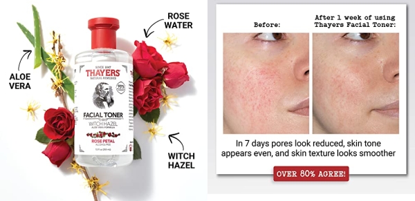 Purchase Thayers Alcohol-Free Rose Petal Witch Hazel Toner with Aloe Vera Formula-12 Oz (Facial Toner) on Amazon.com