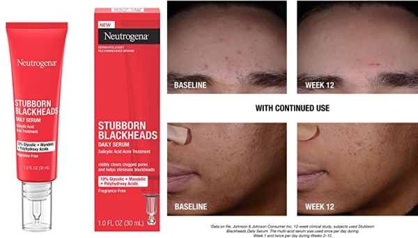Purchase Neutrogena Stubborn Blackheads Daily Acne Facial Serum with Salicylic, Glycolic, Polyhydroxy & Mandelic Acids, Oil-Free Face Serum for Acne-Prone Skin to Help Clear Clogged Pores, 1 fl. oz on Amazon.com