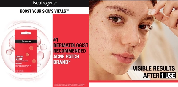 Purchase Neutrogena Stubborn Acne Pimple Patches, Acne Treatment for Face, Ultra-Thin Hydrocolloid Spot Stickers Provide Optimal Healing for Pimples, 24 Patches on Amazon.com
