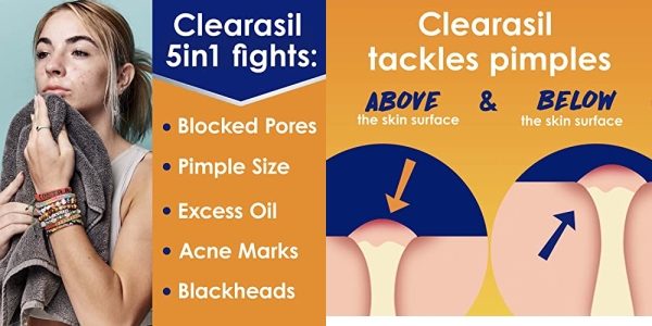 Purchase Clearasil ultra 5 in 1 acne face wash pads, 90 count on Amazon.com